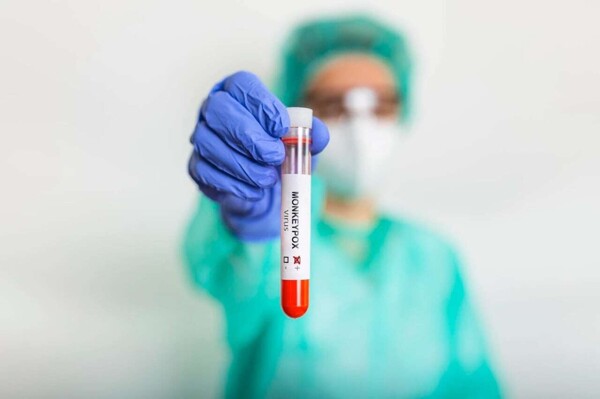 Всемирная организация здравоохранения оценивает вспышки mpox и возможную чрезвычайную ситуацию